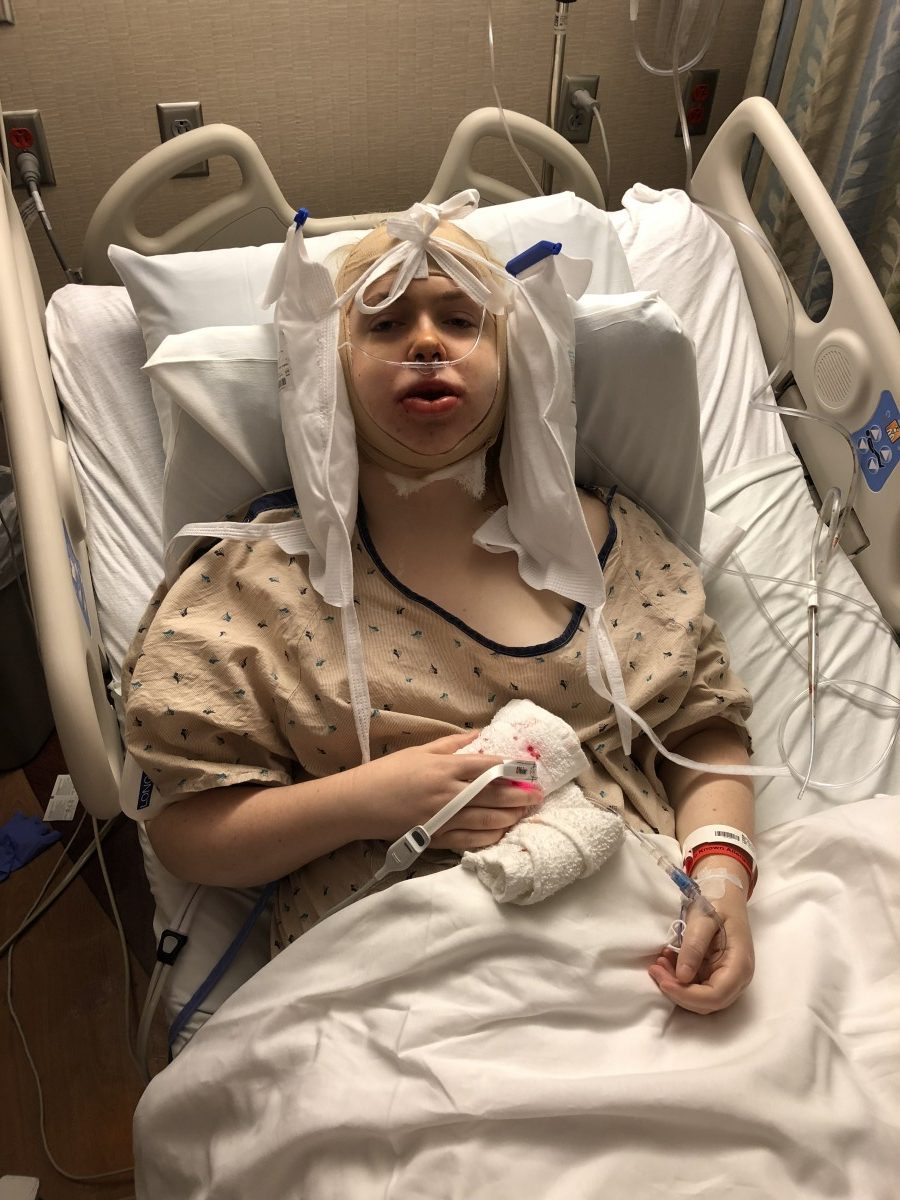 My Double Jaw Surgery Experience: The Good, The Bad, and the Ugly (2 weeks post-op)