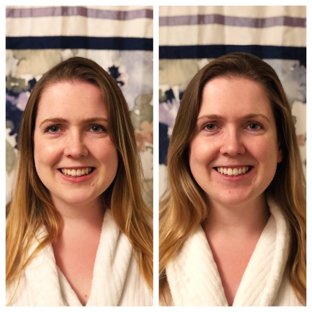 How to make your teeth look like you used a whitening filter in real life