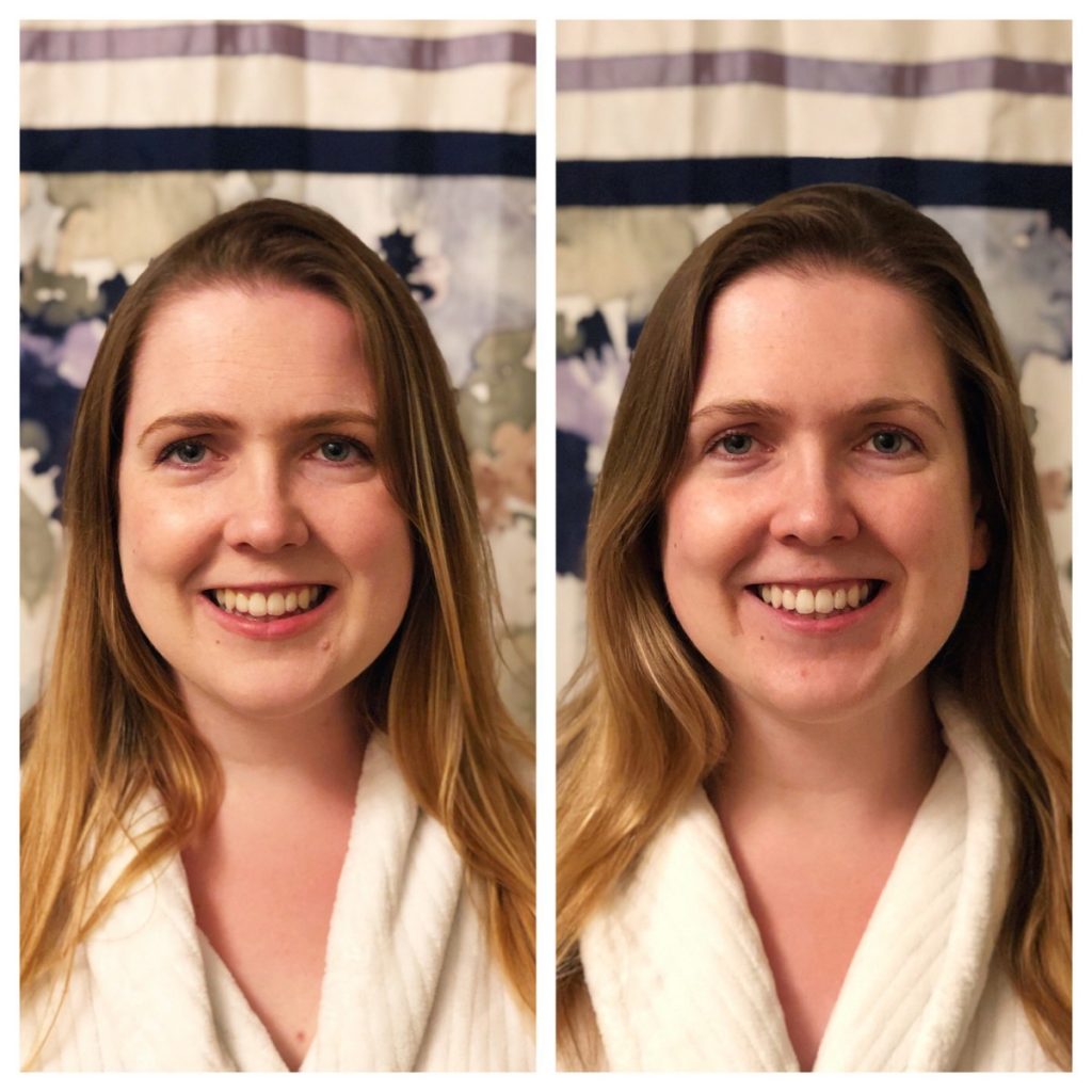 Before and after at home teeth whitening results - Her Heartland Soul