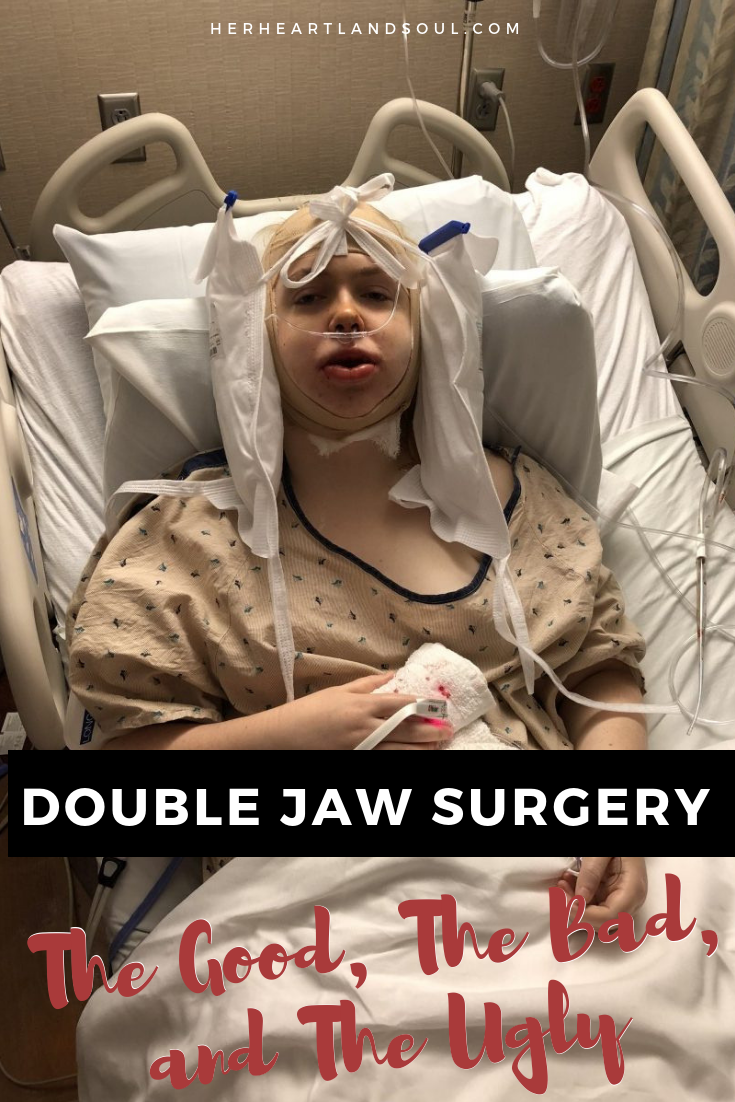 My Double Jaw Surgery Experience The Good The Bad And The Ugly 2 Weeks Post Op Her